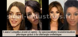 Laura Lempika : Avant et Après, une Transformation Étonnante