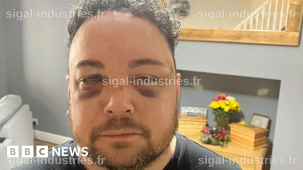 Un homme de Chelan frappe un adjoint lors de son arrestation pour tentative de cambriolage d'appartement